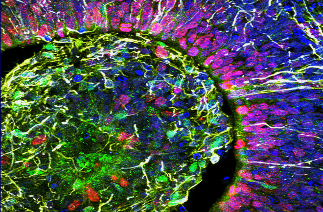 Brain-Organoid