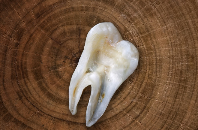 tooth
