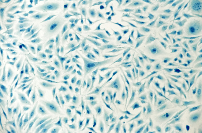 HeLa cervical cancer cells, stained with Coomassie blue, under microscope.