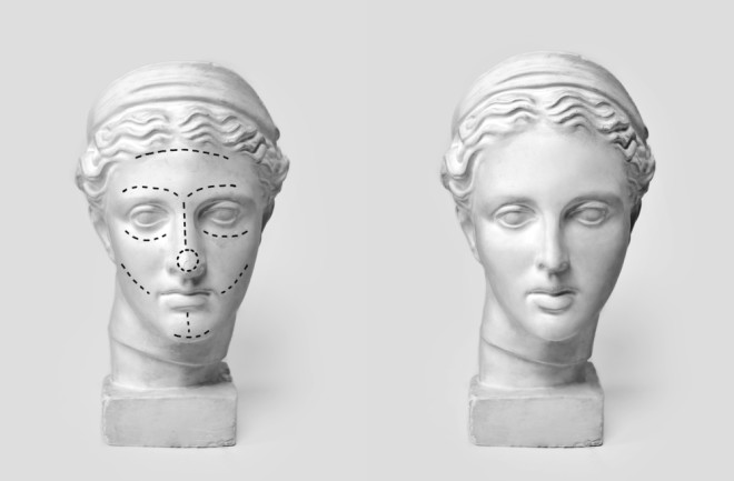 Two classical sculpture busts side by side with dotted lines representing plastic surgery incisions