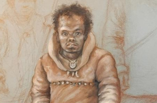 Reconstruction of a 16-year-old ice age teenager with a form of dwarfism who lived 11,000 years ago
