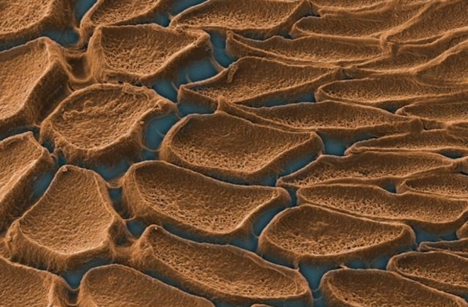 squid-teeth-microscope